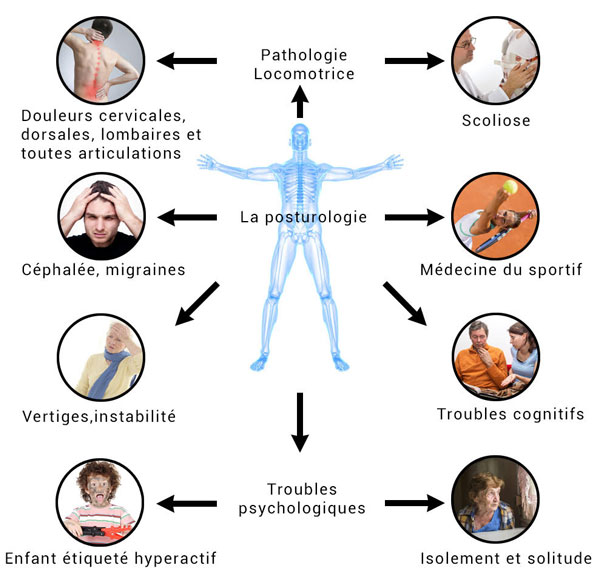 4 Pathologies posturales